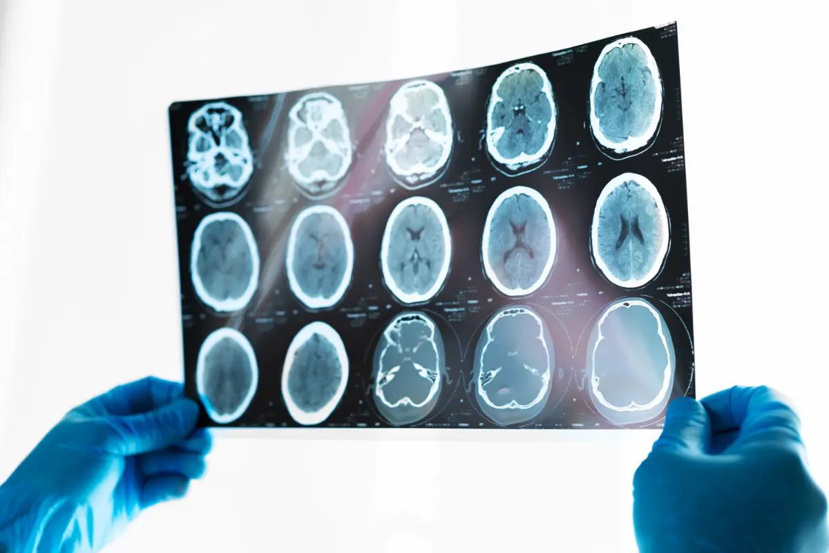 Reviving the Mind The Potential of Hyperbaric Oxygen Therapy for